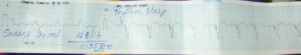 Child With A Mechanical Heart Valve